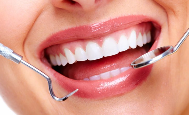 Smile Care Dental clean and clear teeth