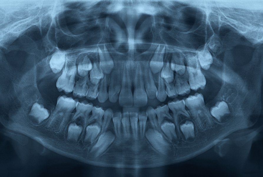 Smile Care Dental teeth skeleton