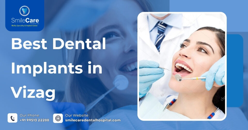 best dental implants in Visakhapatnam