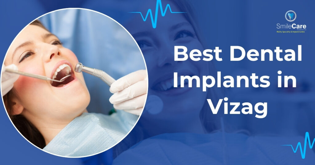 Dental Implants in Vizag