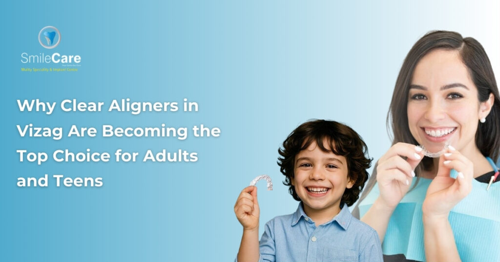 Clear Aligners in Vizag