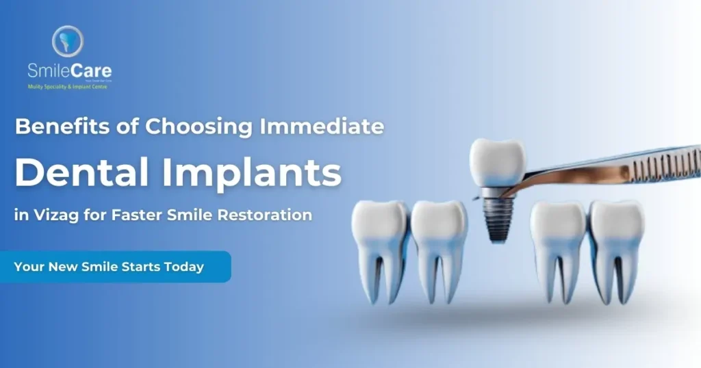 Immediate Dental Implants in Vizag