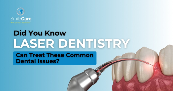 Laser dental treatment in Vizag