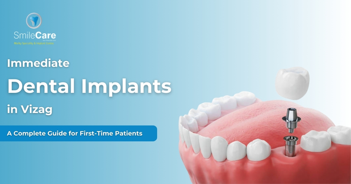 immediate implants in vizag