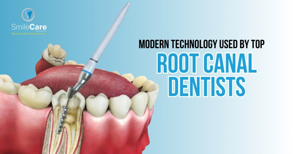 Best root canal dentist in Vizag