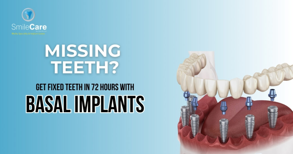 basal implants in vizag