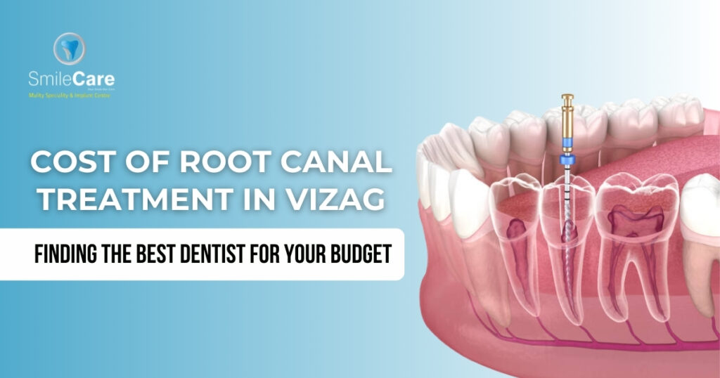 Best root canal dentist in Vizag