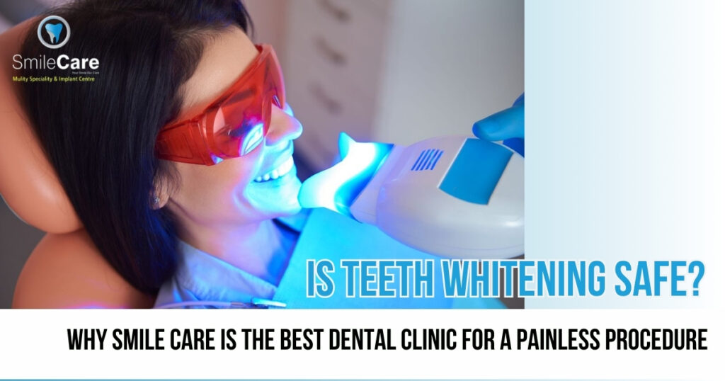 Teeth whitening expert in vizag