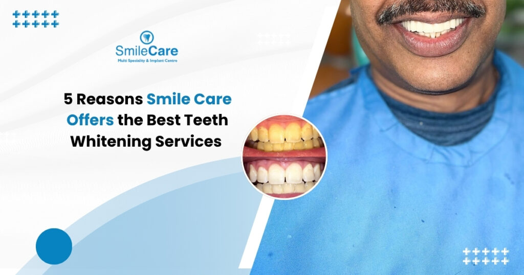 Teeth whitening in Vizag