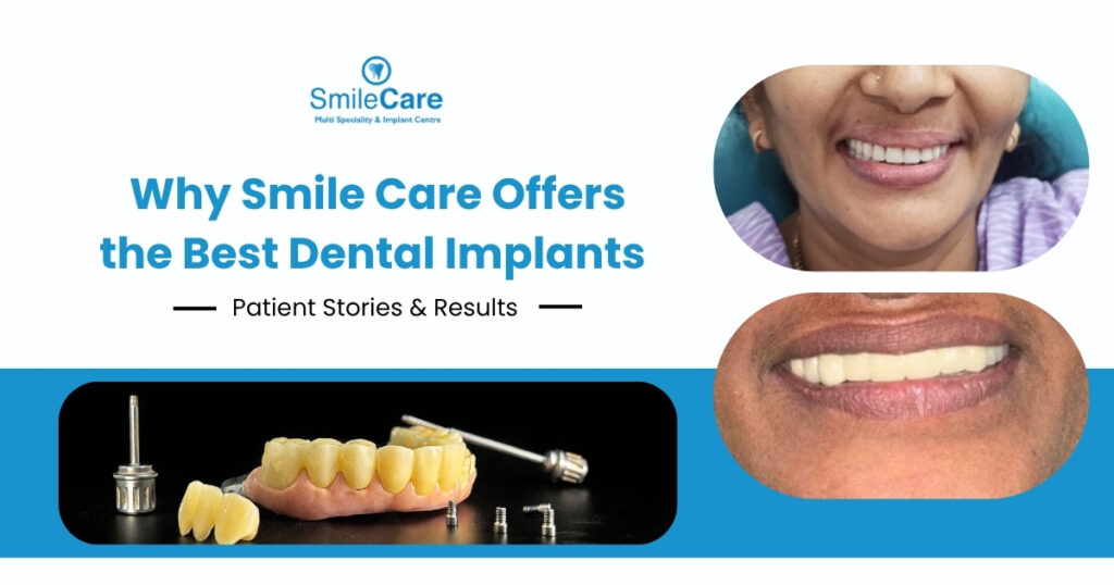 dental implants in Vizag