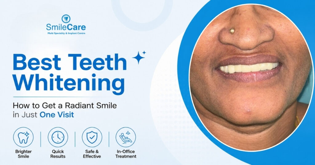 Best Teeth Whitening in Vizag