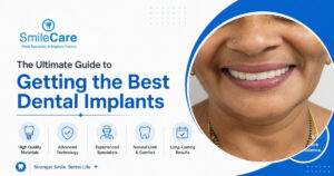 best dental implants in Visakhapatnam