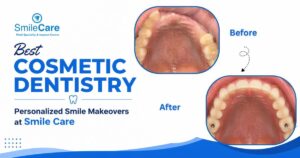 Cosmetic Dentistry in Vizag