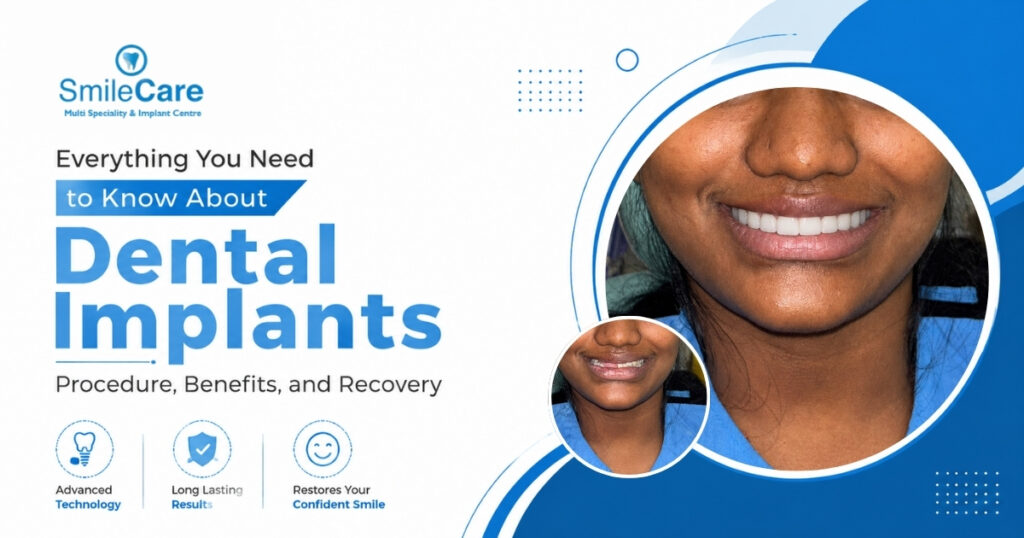 best Dental Implants in Vizag