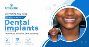 best Dental Implants in Vizag