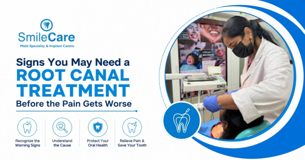 root canal treatment in Vizag
