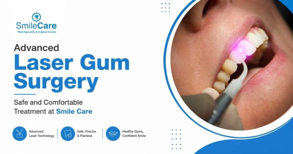 Gum Surgery in Vizag