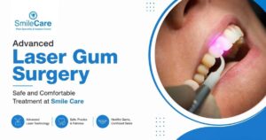 Gum Surgery in Vizag