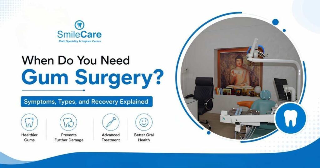 Gum Surgery in Vizag