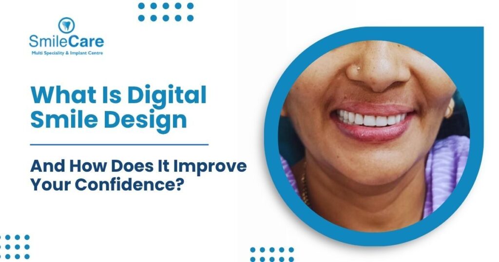 Smile Design in Vizag