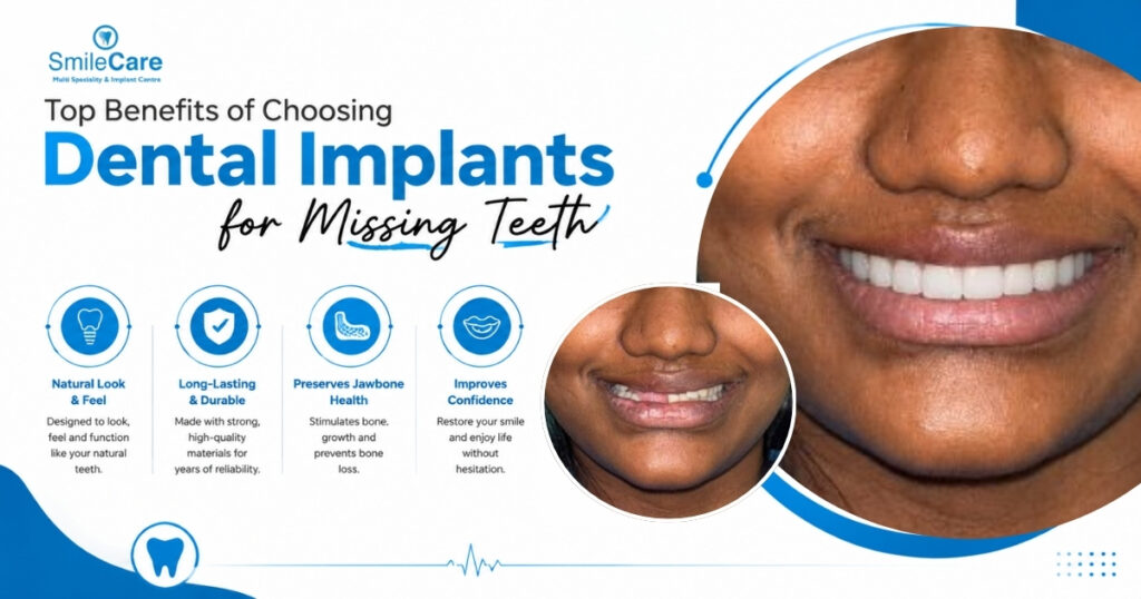 dental implants in Vizag