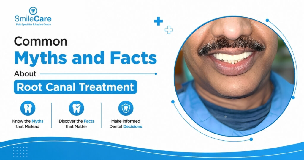 root canal treatment in Vizag