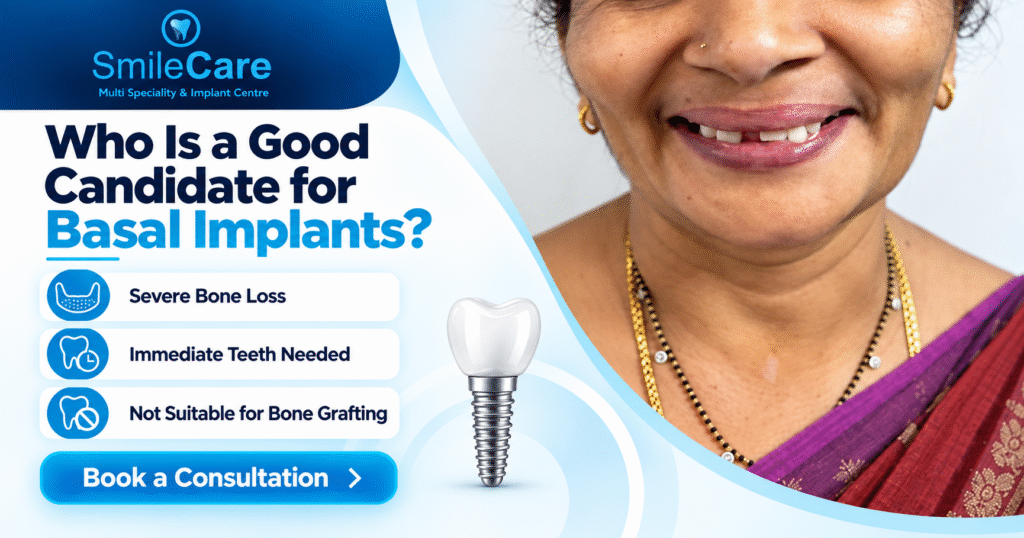 Basal Implants in Vizag