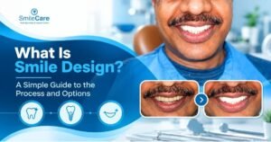 Smile Design in Vizag